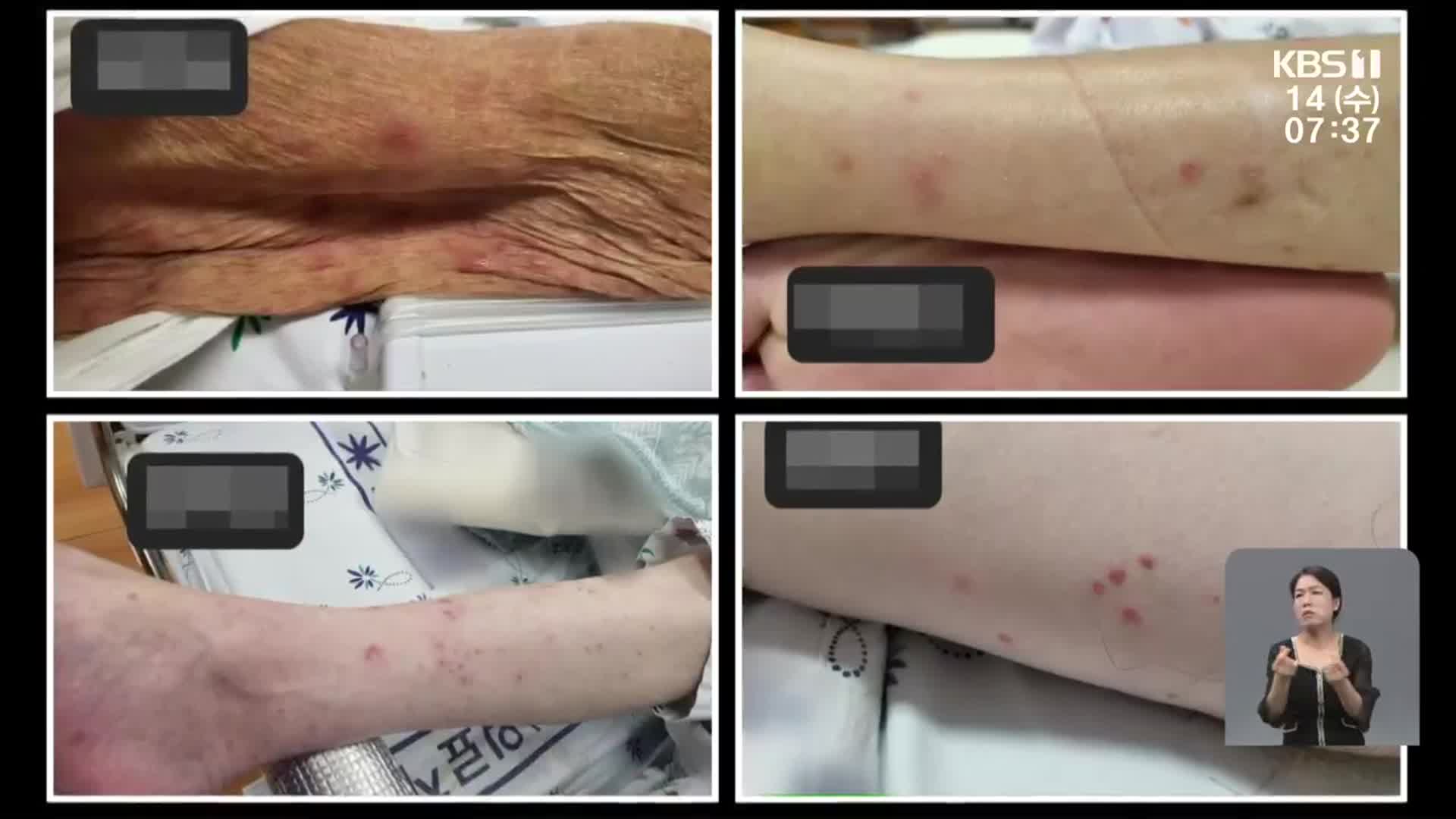 광주 시립제1요양병원서 피부질환자 속출…전문가 “옴 의심”
