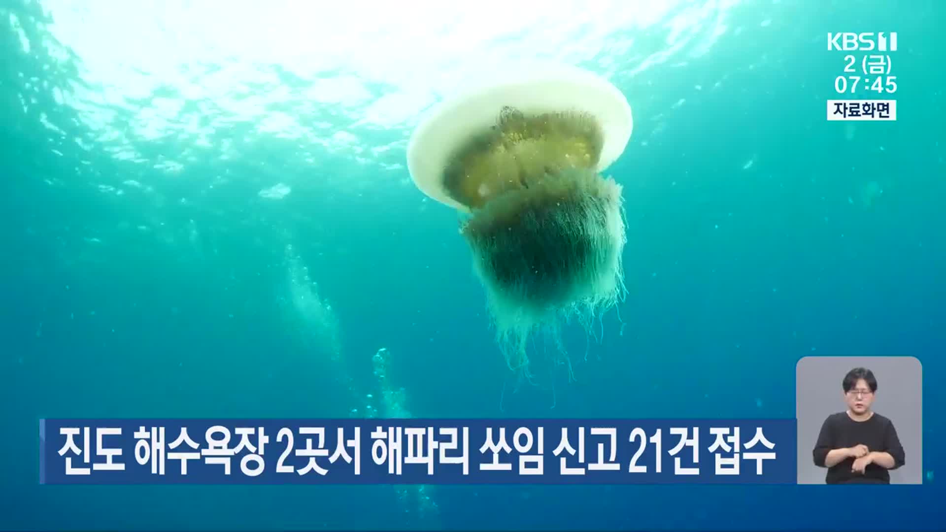 진도 해수욕장 2곳서 해파리 쏘임 신고 21건 접수