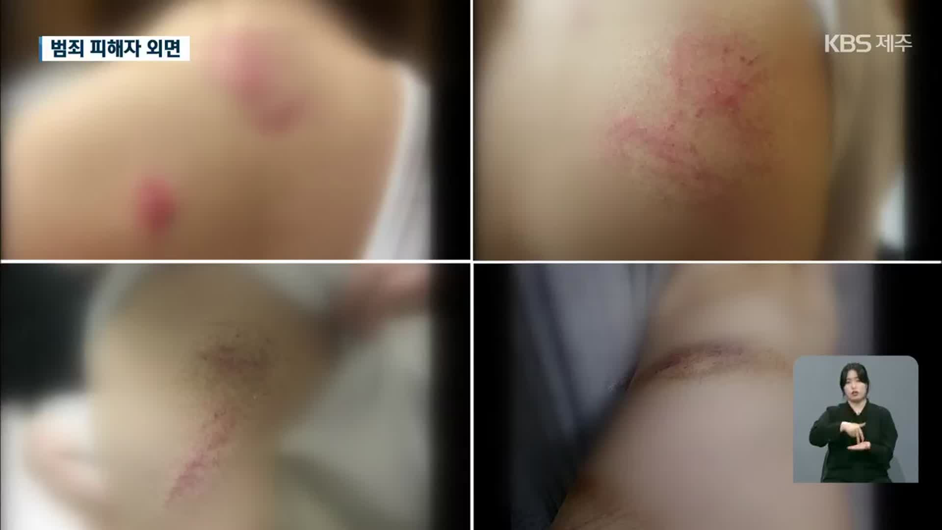흉기 찔린 여성 외면한 범죄피해자지원센터