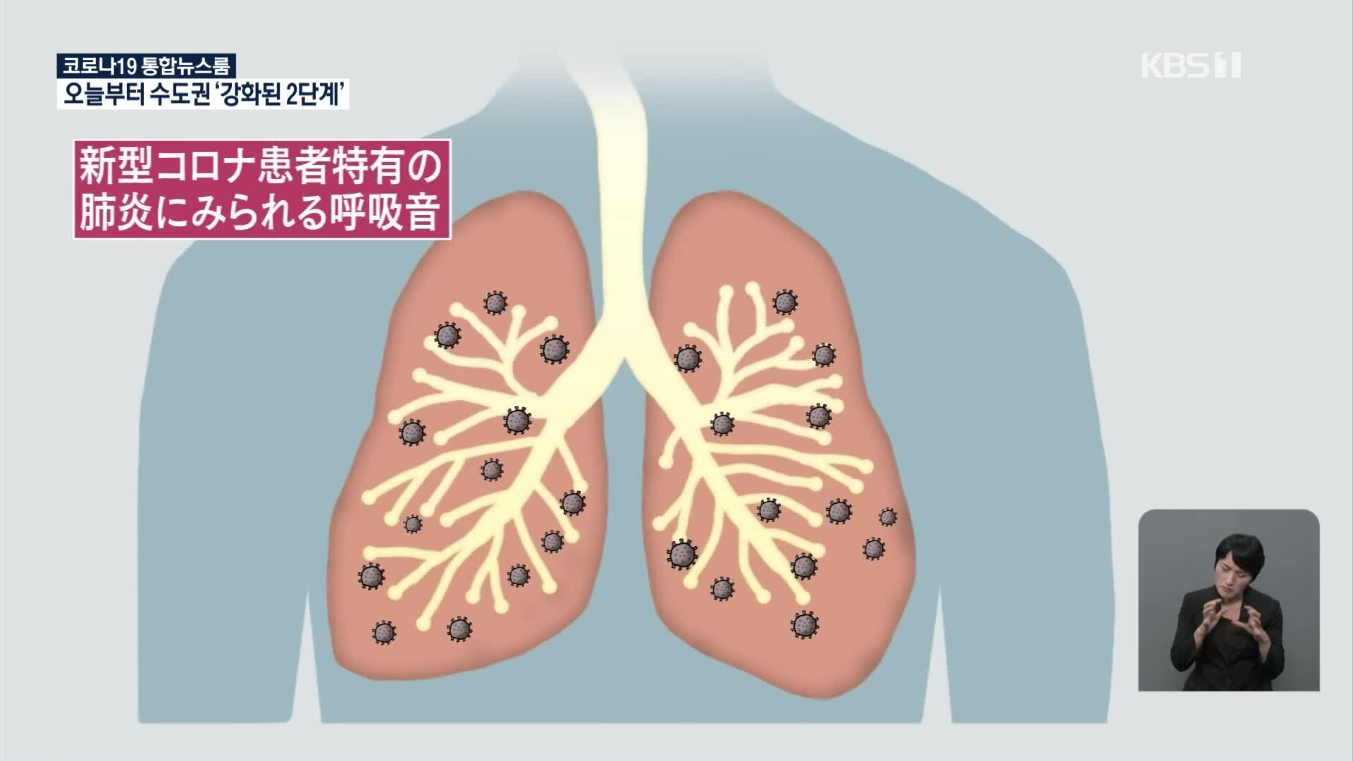 일본서 폐 소리로 코로나19 환자 상태 진단