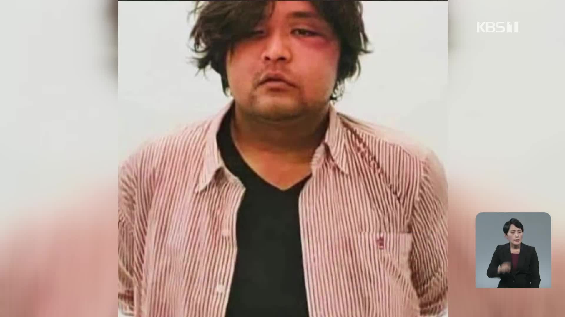KBS 인터뷰 뒤 체포된 미얀마 ‘리틀판다’…“아들 살려주세요”