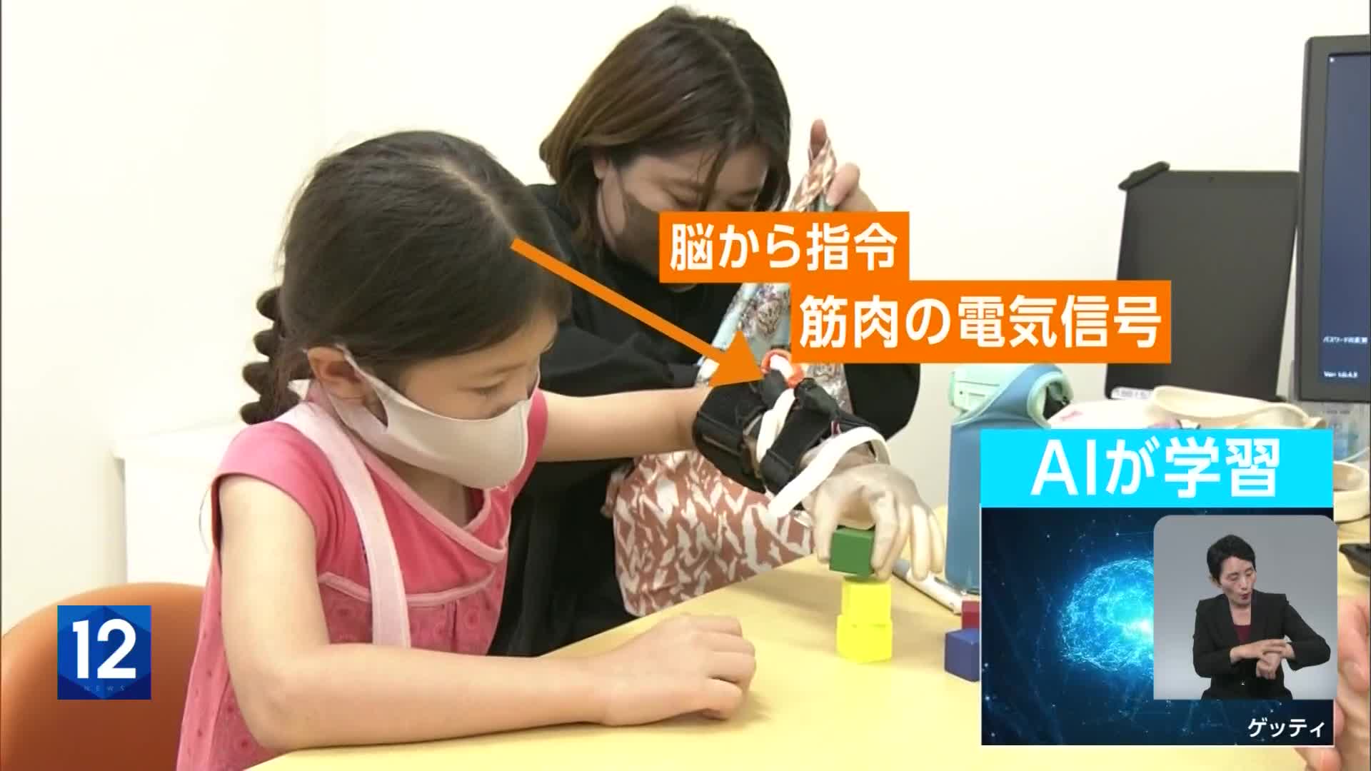 일본 의료계에 부는 ‘AI 바람’
