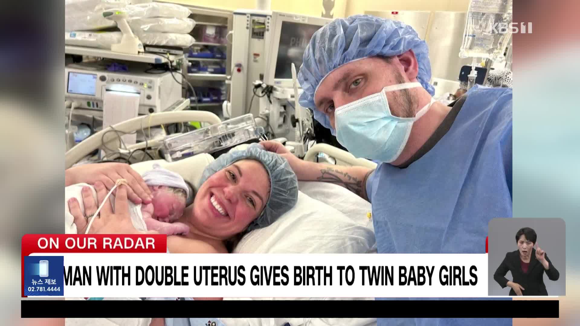 미국, 자궁 두 개 여성 딸 쌍둥이 출산