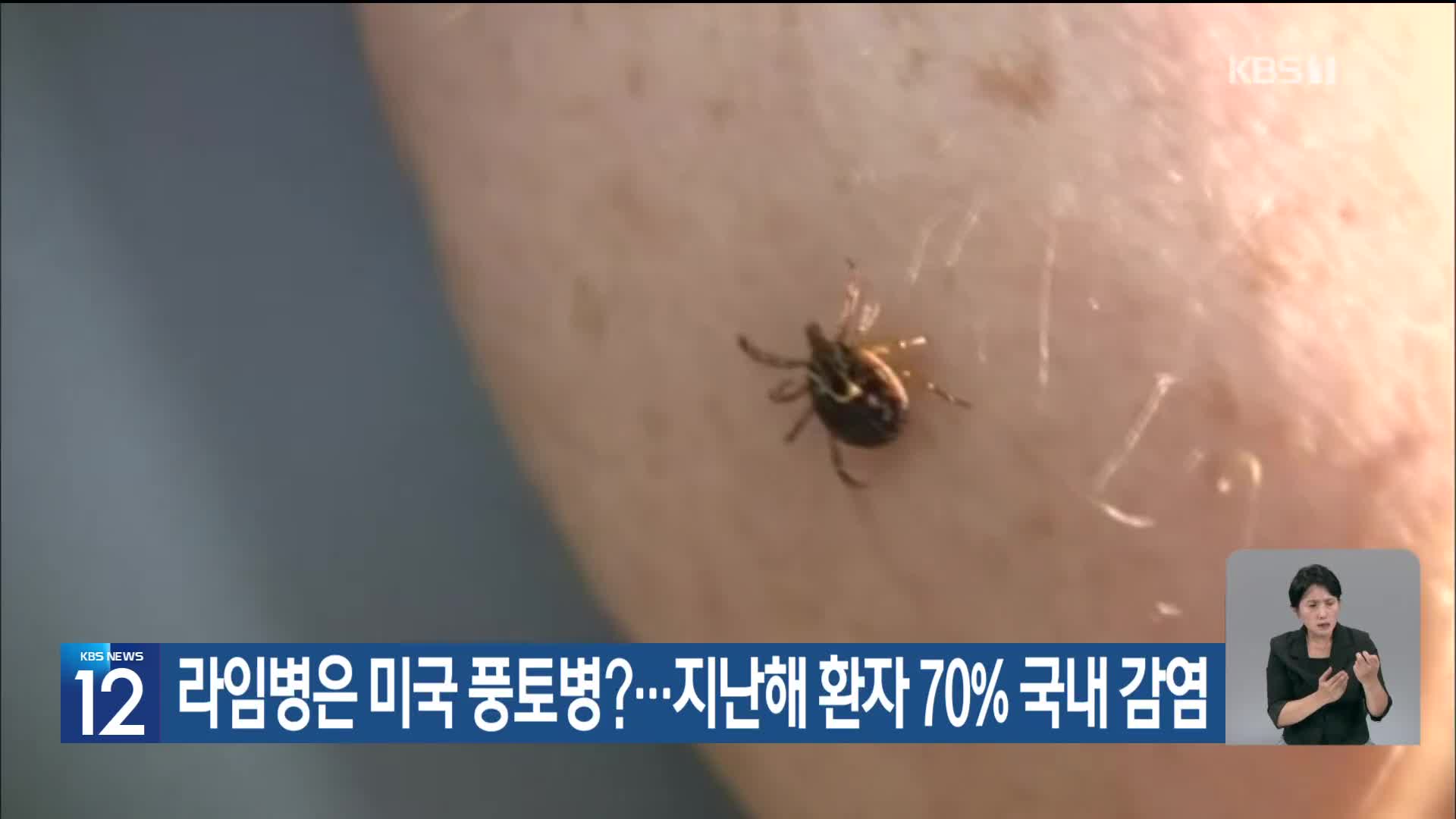 [기후는 말한다] 라임병은 미국 풍토병?…지난해 환자 70% 국내 감염