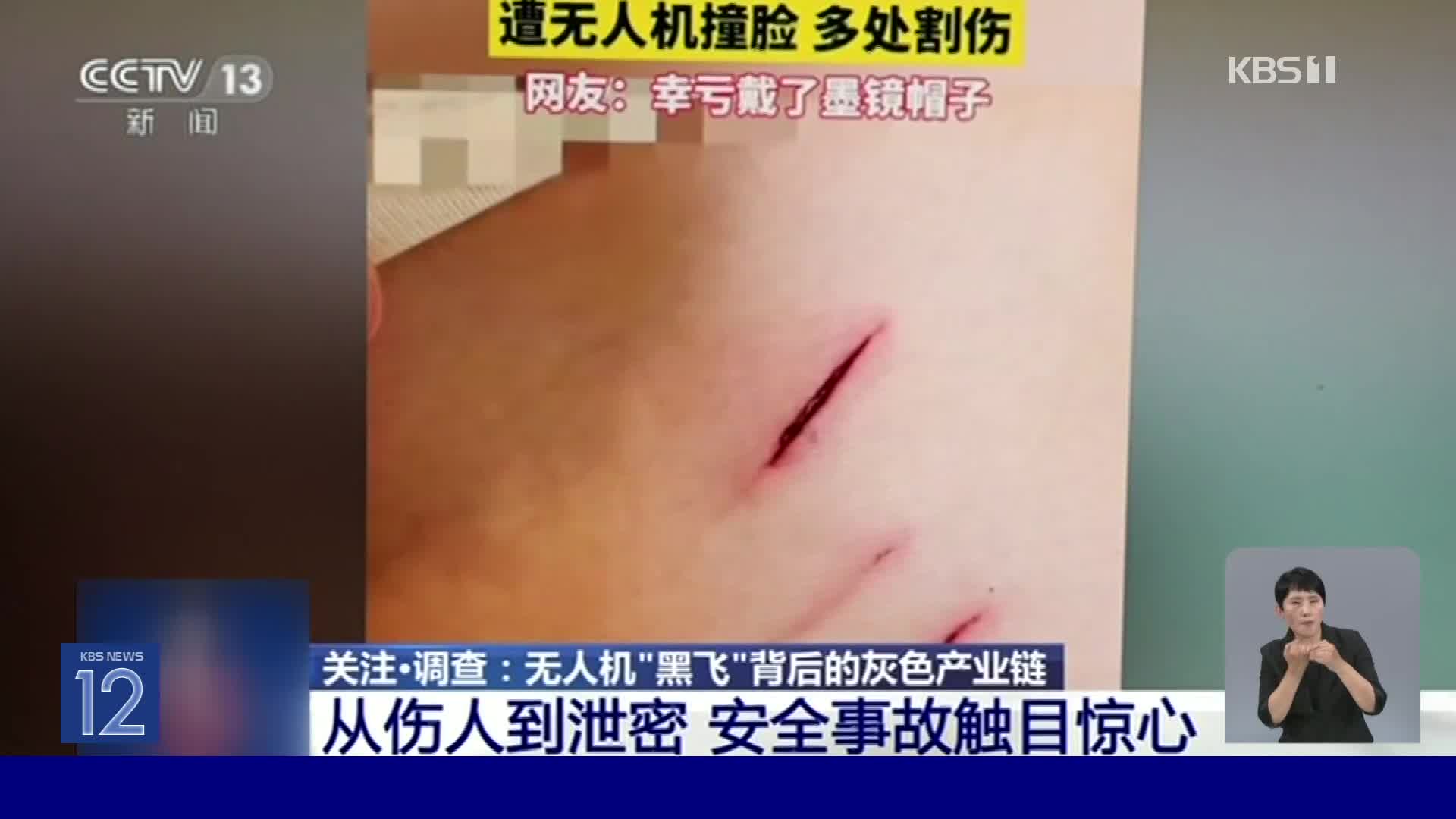 중국, 얼굴 부상에 항공기 지연까지…드론 사고 잇따라