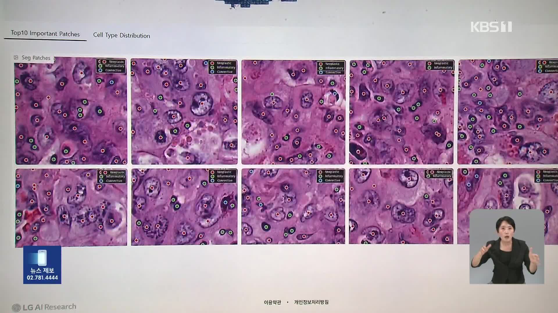 암 진단하는 AI까지…“‘맞춤형 독자 AI’ 각광”