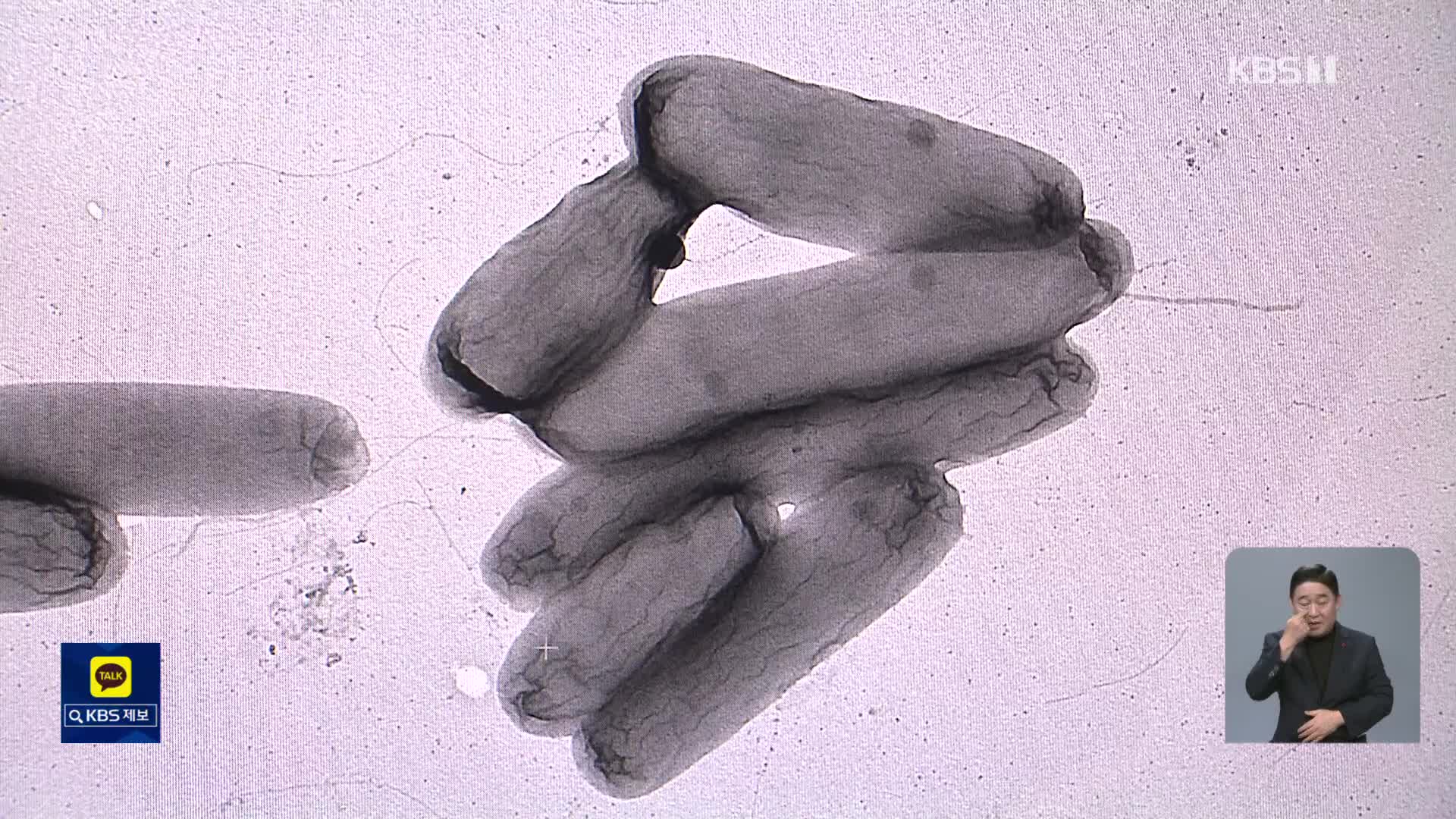 미세먼지 속 세균 ‘호흡기 손상 과정’ 첫 규명