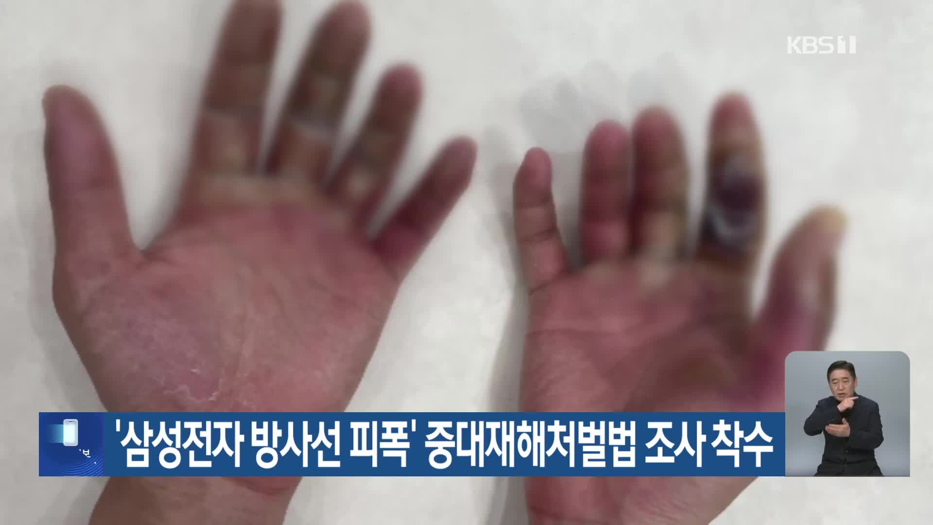 ‘삼성전자 방사선 피폭’ 중대재해처벌법 조사 착수