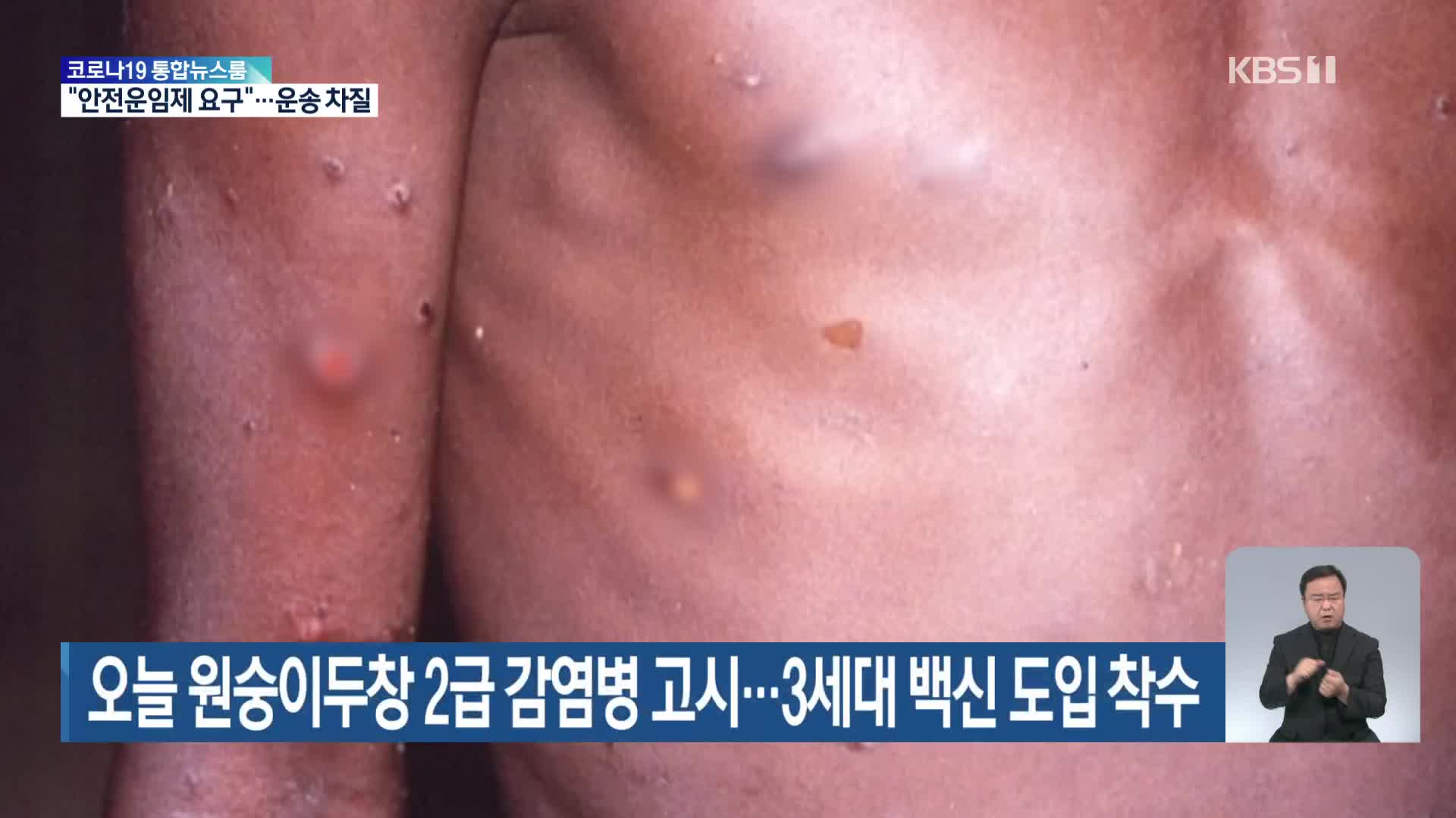 오늘 원숭이두창 2급 감염병 고시…3세대 백신 도입 착수