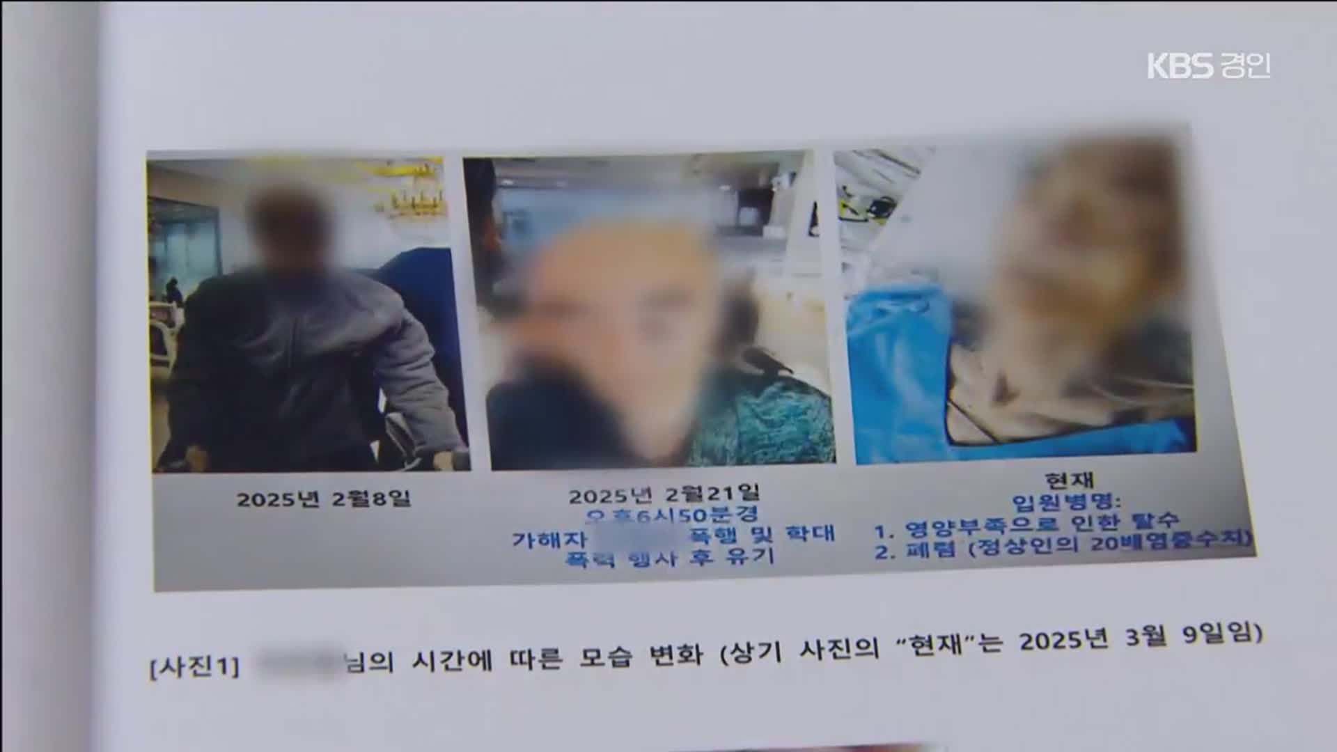 주먹으로 때리고 집어 던지고…요양원 치매 노인 학대 실태는?