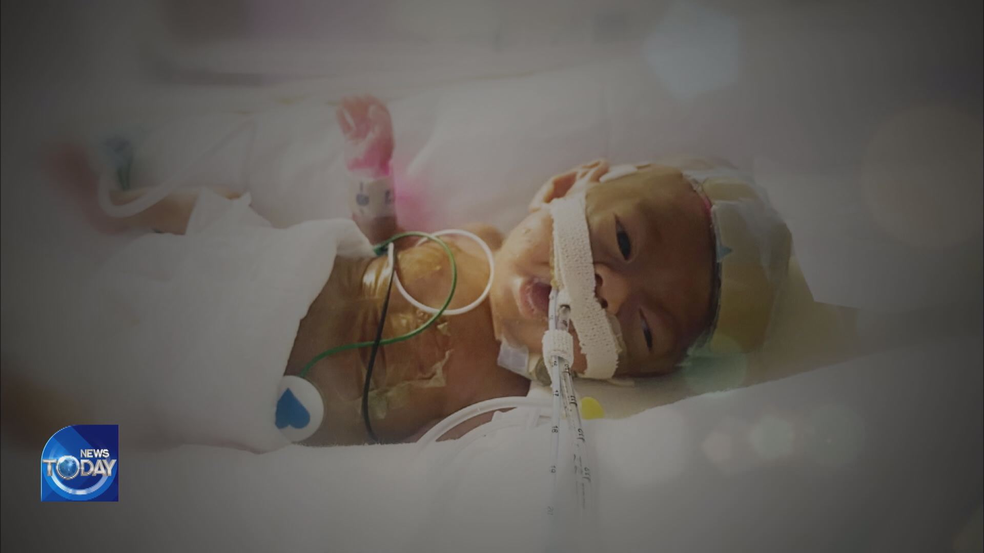 MIRACLE STORY OF A PREMATURE