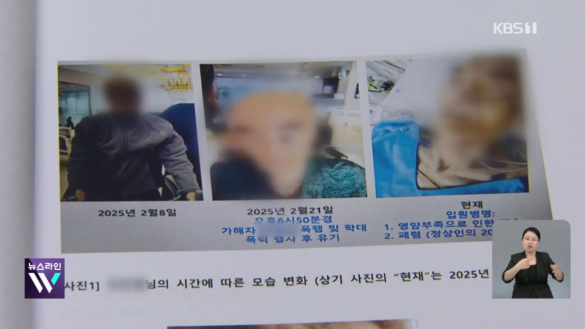 주먹으로 때리고 집어 던지고…요양원 치매 노인 학대 실태는?