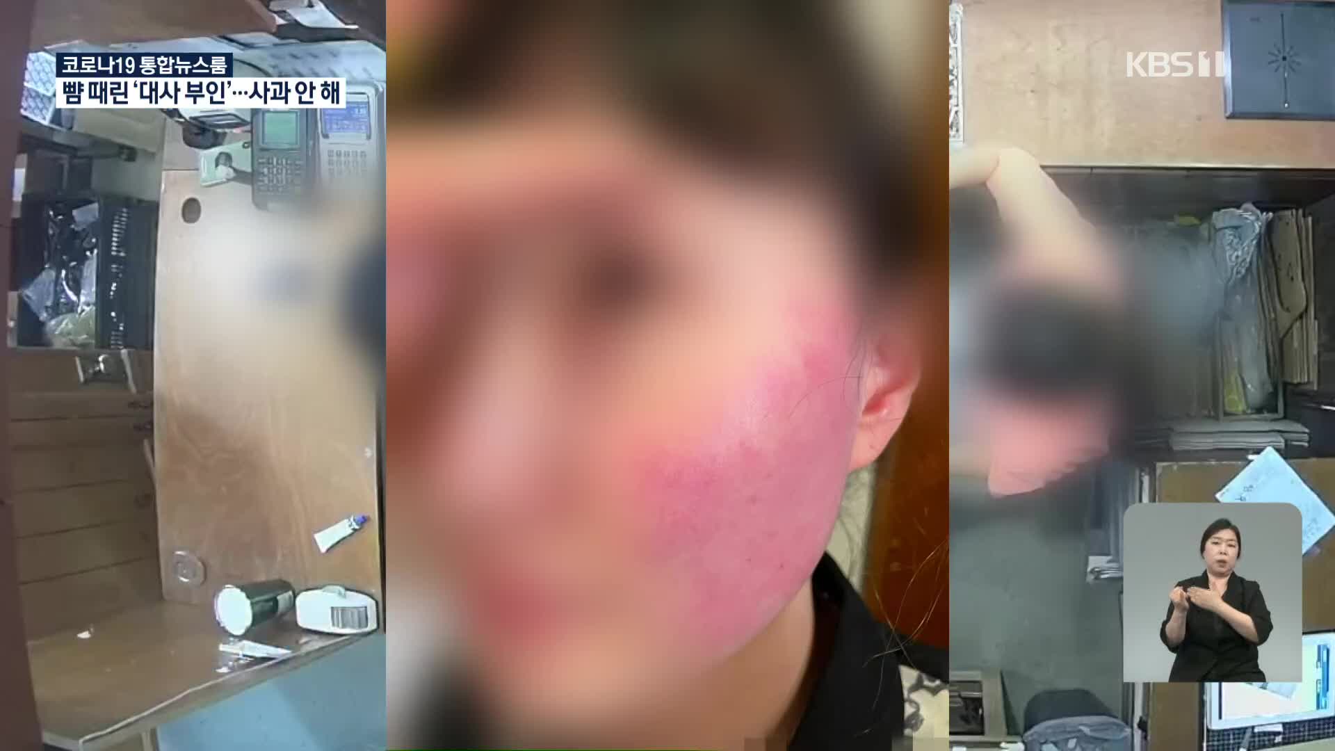 뺨 맞은 직원 “벨기에 대사 부인 사과 없어”…경찰 출석도 불응