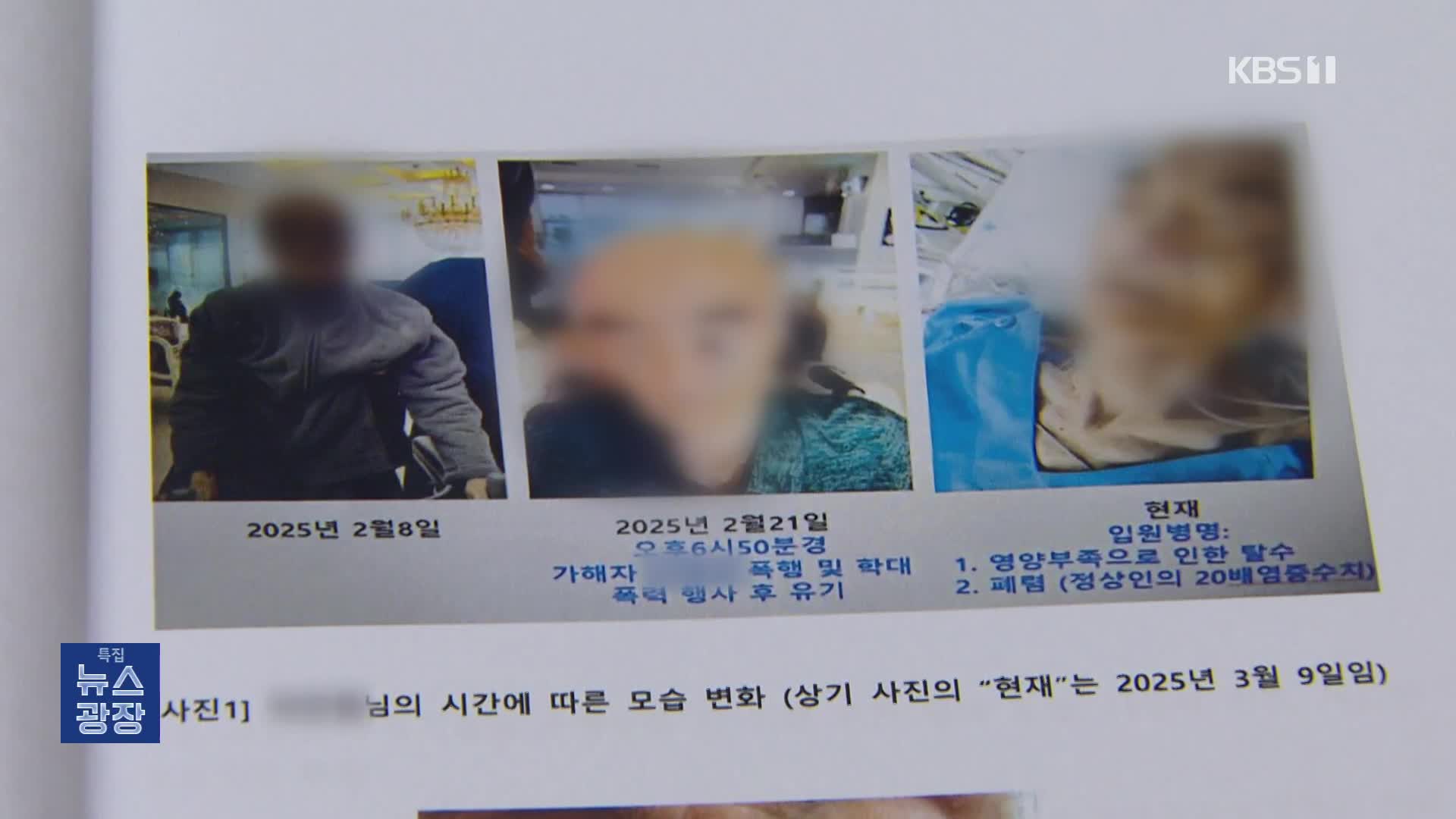 주먹으로 때리고 집어 던지고…요양원 치매 노인 학대 실태는?