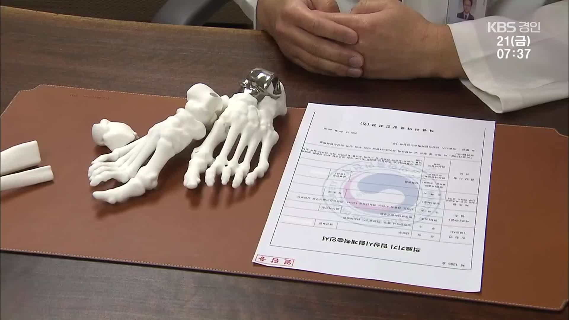 국내 첫 ‘3D프린팅 발목뼈 치환술’ 성공…의료계 확산