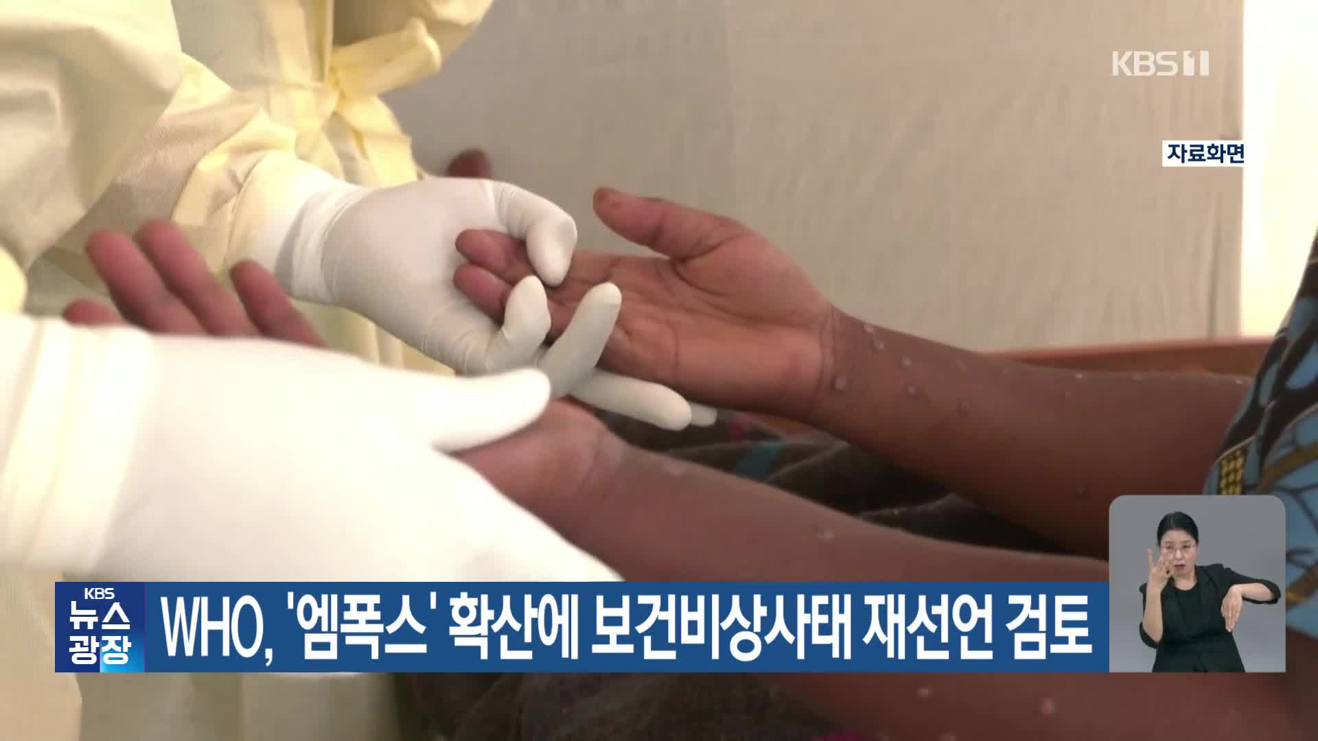 WHO, ‘엠폭스’ 확산에 보건비상사태 재선언 검토