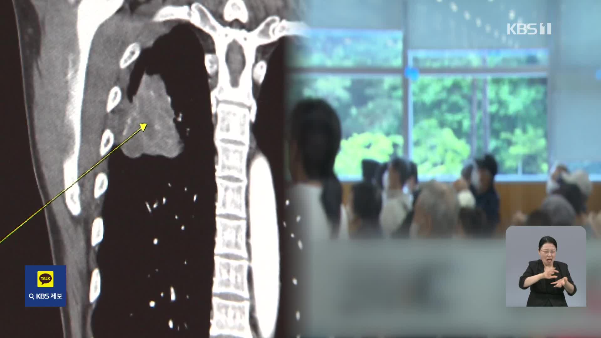 과도한 ‘병원 순례’, 폐암 환자 사망 위험 높인다
