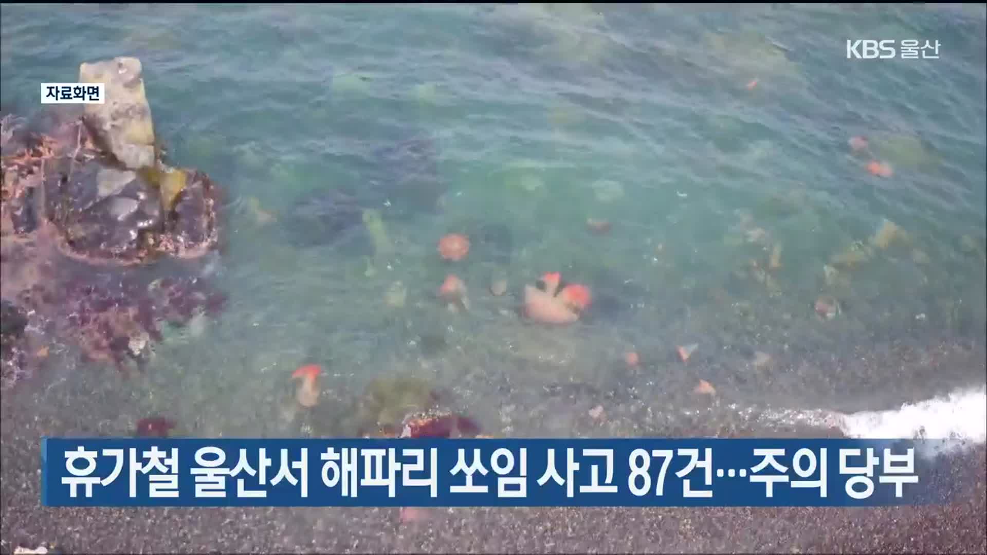 휴가철 울산서 해파리 쏘임 사고 87건…주의 당부