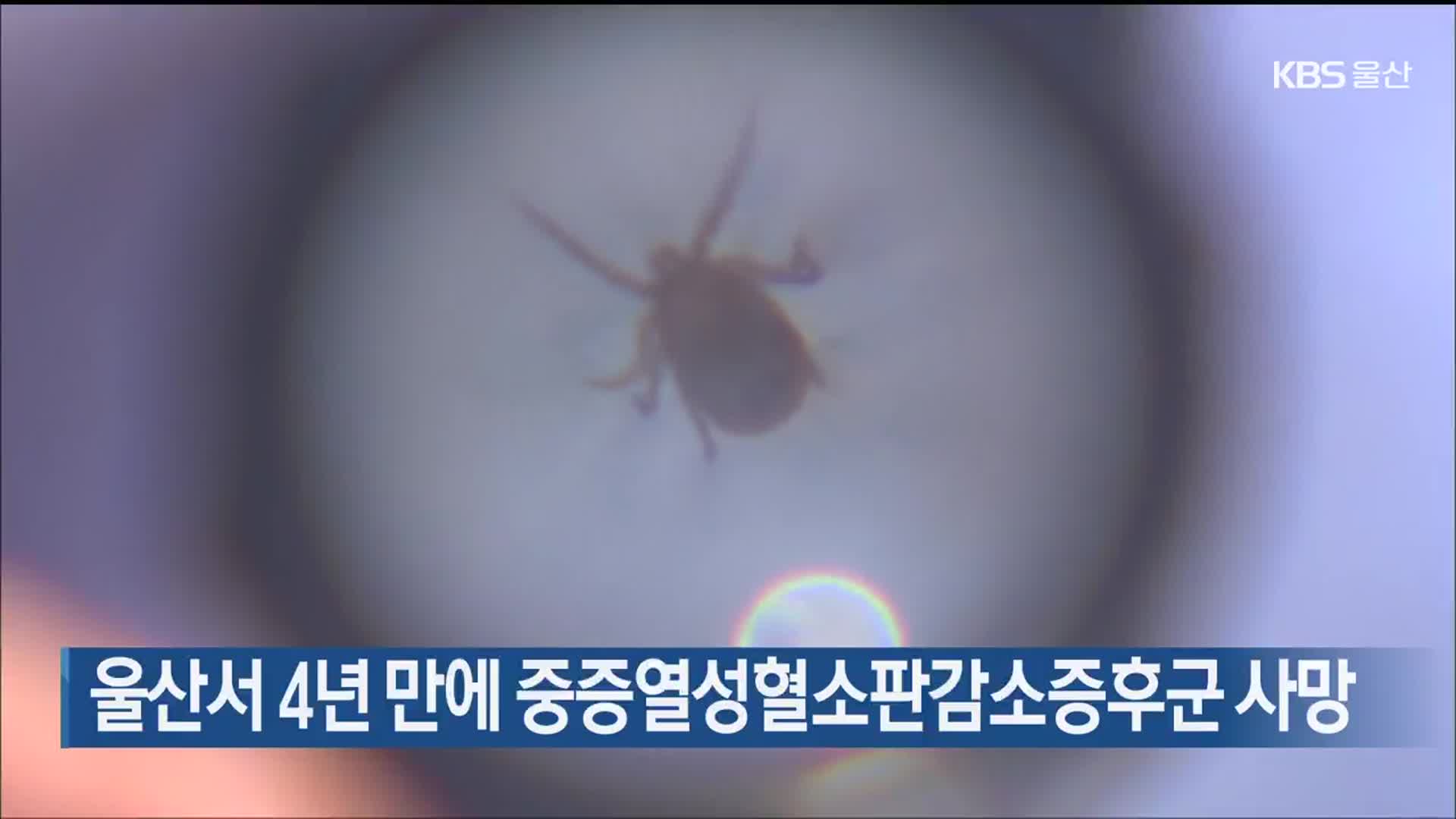 울산서 4년 만에 중증열성혈소판감소증후군 사망