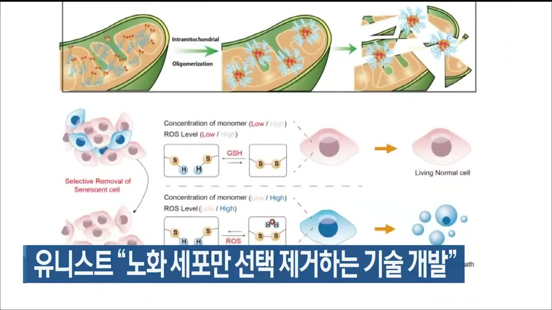 유니스트 “노화 세포만 선택 제거하는 기술 개발”