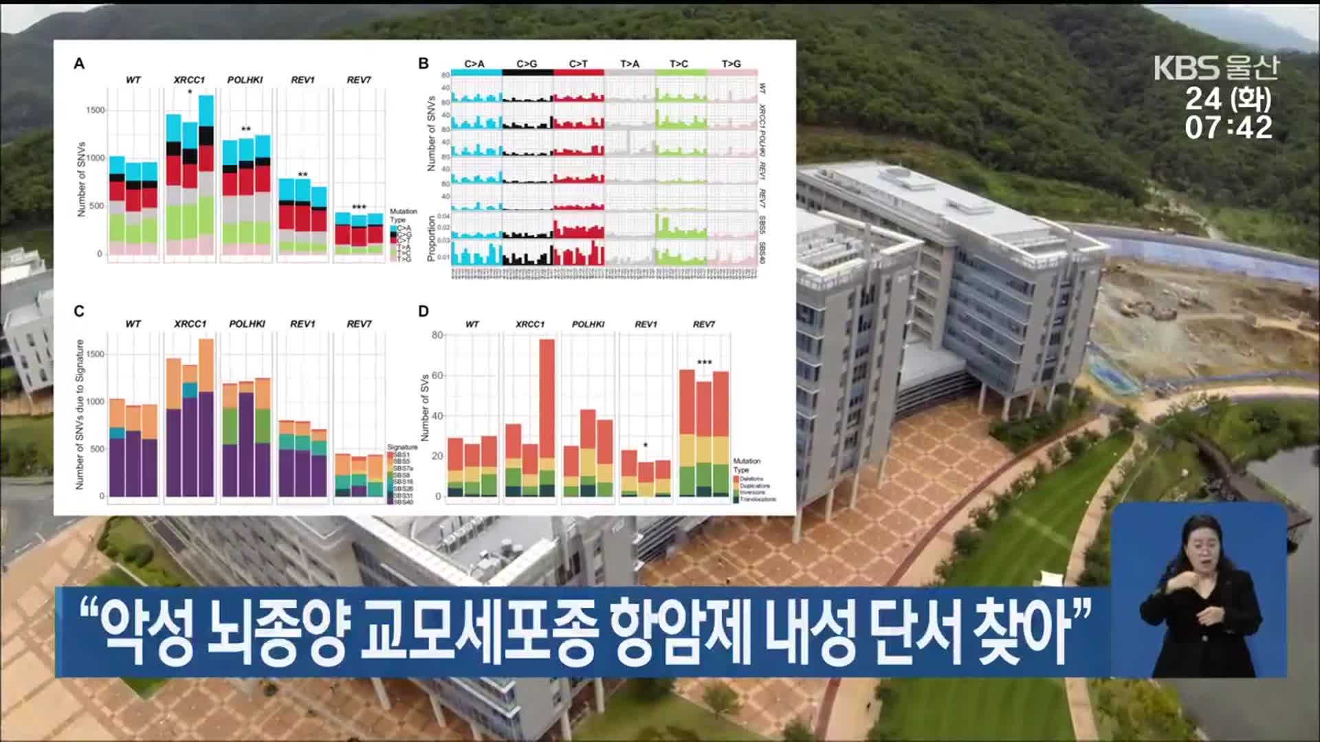 “악성 뇌종양 교모세포종 항암제 내성 단서 찾아”