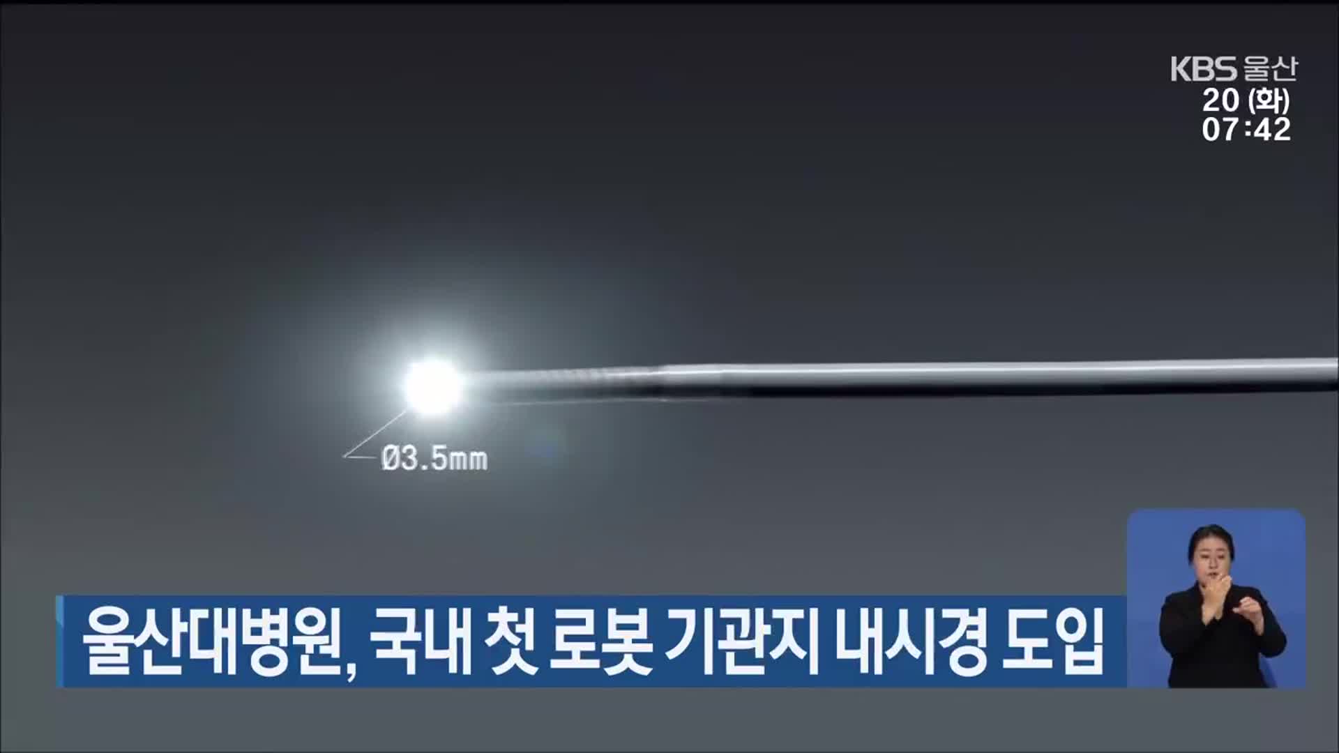 울산대병원, 국내 첫 로봇 기관지 내시경 도입
