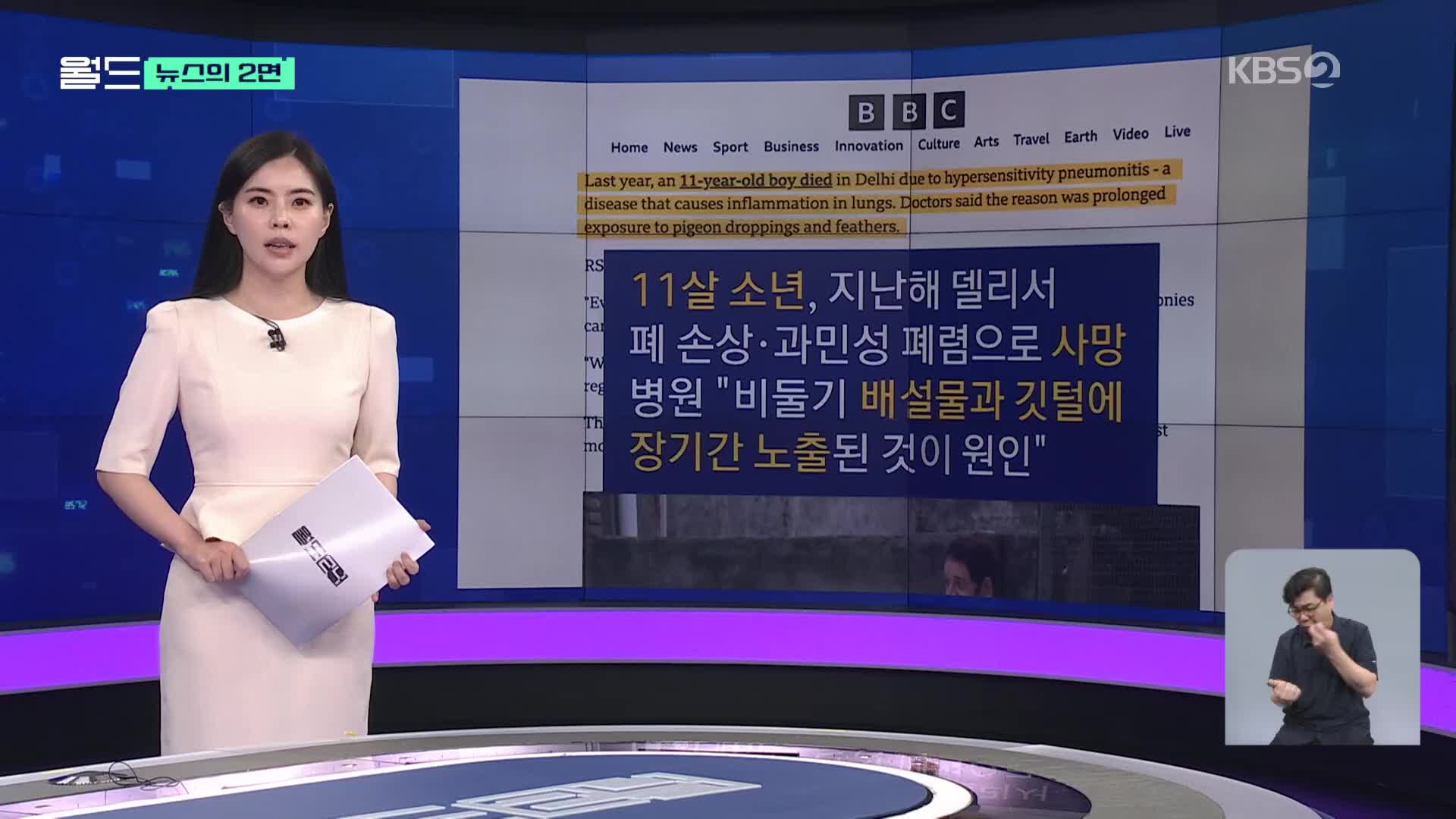 [뉴스의 2면] ‘과민성 폐렴’ 11살 사망…급기야 ‘비둘기 먹이 주기’ 금지
