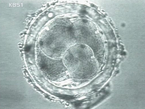 배아 줄기세포 복제 성공 단계는? 