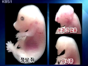 ‘임신 중 음주’ 얼굴 기형 출산 원인 규명 