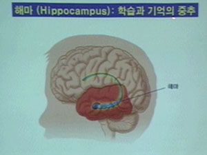 산모 스트레스가 태아 뇌 손상 유발 