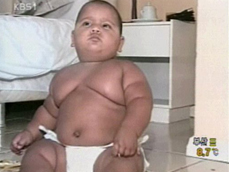브라질 한 살 아기 몸무게 25kg 