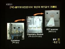 영상 촬영으로 암 악성도 조기 진단 