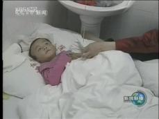중국, 수족구병으로 80명 이상 사망 