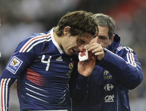 19일(한국시간) 홈구장 생드니 스타드 드 프랑스에서 열린 프랑스와 아일랜와의 2010년 남아공 월드컵 유럽 최종 플레이오프 2차전에서 프랑스 수비수 줄리앙 에스퀴데가 부상을 입고 의료진의 치료를 받고 있다. 